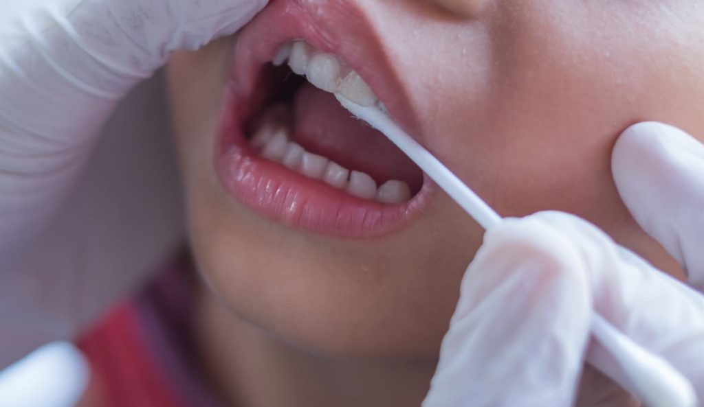Fluoride Therapy