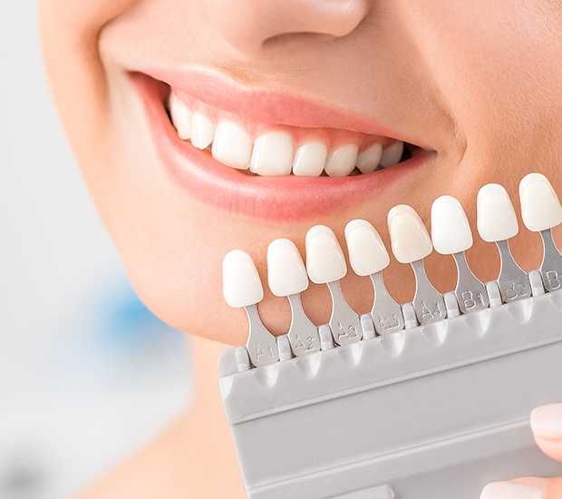 Dental Crowns and Bridges in Thornhill