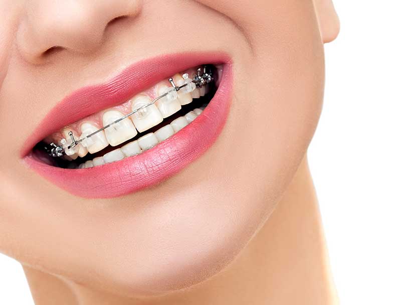 Six Month Smiles in Thornhill