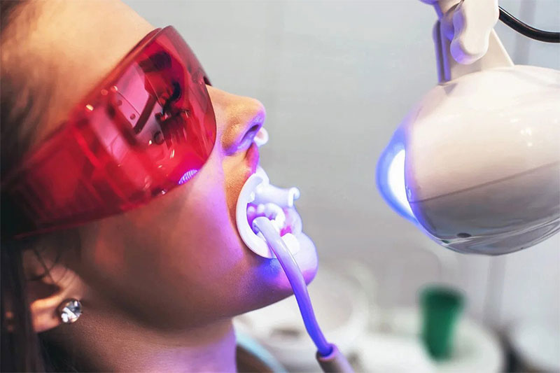 Teeth Whitening in Thornhill